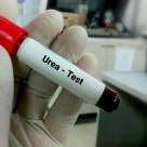 Sanatate